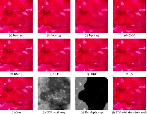 Figure 5 From Parameter Free Gaussian Psf Model For Extended Depth Of Field In Brightfield