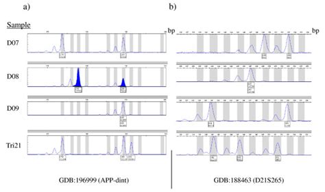 Electropherograms Of Microsatellite Markers For Three Different Dna Download Scientific