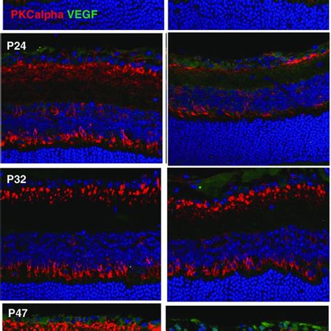 Vegf A 165 Expression And Synaptic Integrity In Ra And Oir Vegfa 165 Download Scientific