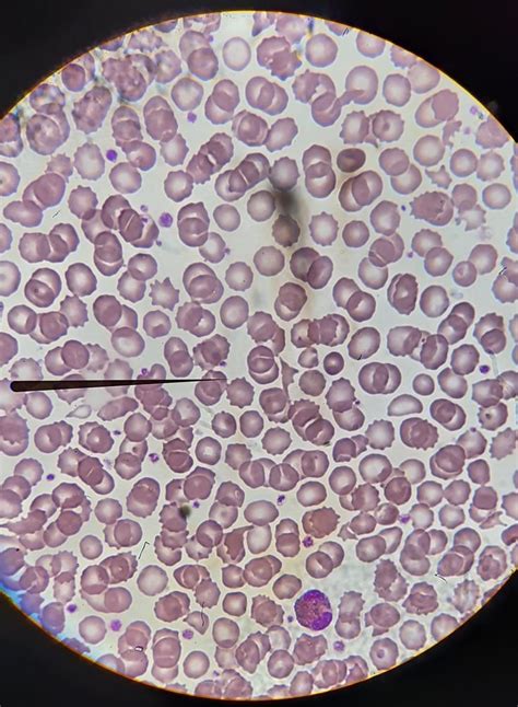 Serie Roja Hematolog A