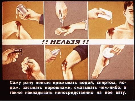 Самая первая помощь — как надо действовать в реальности. — DRIVE2