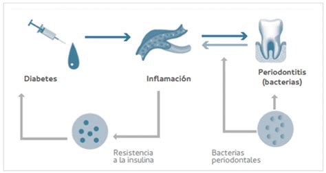 La inflamación y la relación de la diabetes mellitus con la enfermedad