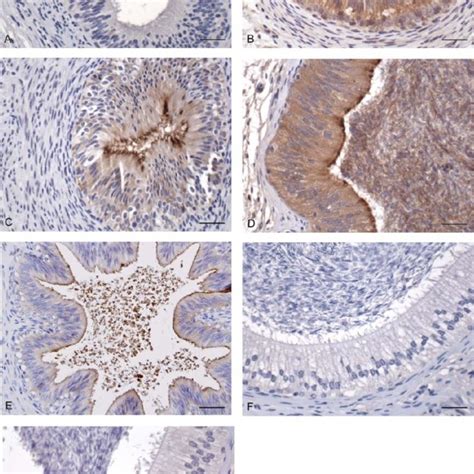 Immunohistochemical Localization Of Bbd126 In The Bovine Epididymis