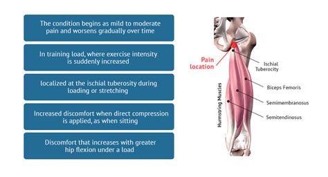 Best Options For Prevention And Treatment Of Proximal Hamstring