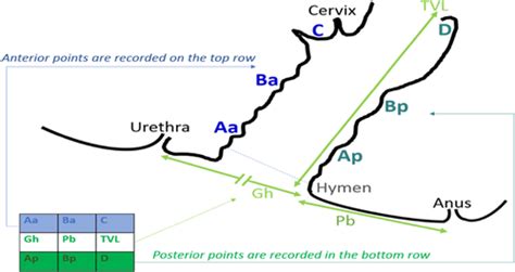 How To Use The Pelvic Organ Prolapse Quantification Pop‐q System Madhu 2018