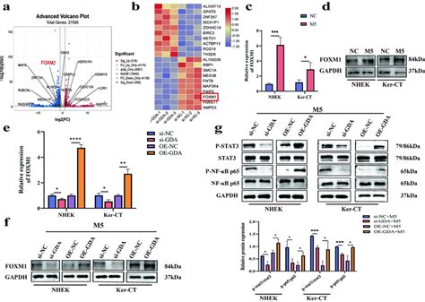 Gda Regulates Foxm1 And Activates Stat3nf κb Signaling Pathway A