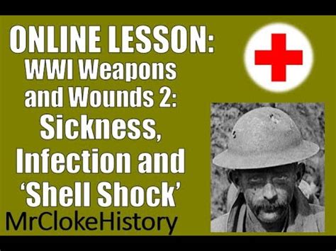 GCSE History WWI Medicine Trench Foot Sickness Infection And