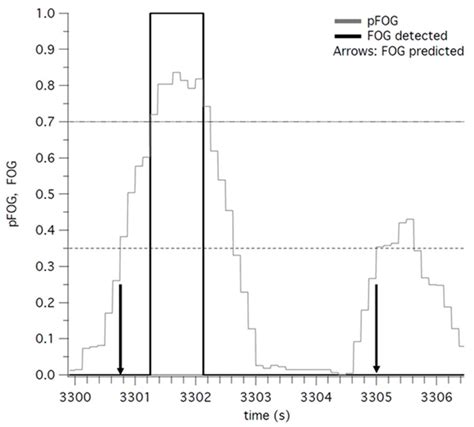 Refinement of an Algorithm to Detect and Predict Freezing of Gait in