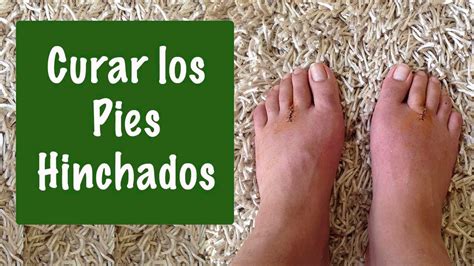 Como Desinflamar Los Pies Remedios Naturales Para Los Pies Hinchados