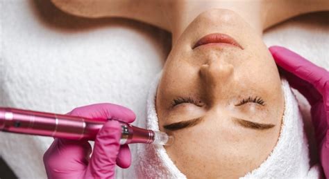 How Microneedling Plus Cupping May Help Your Skin La Plastic Surgery