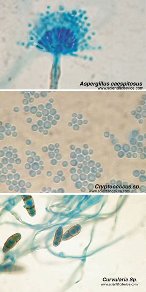 Candida Albicans Microscope Slide