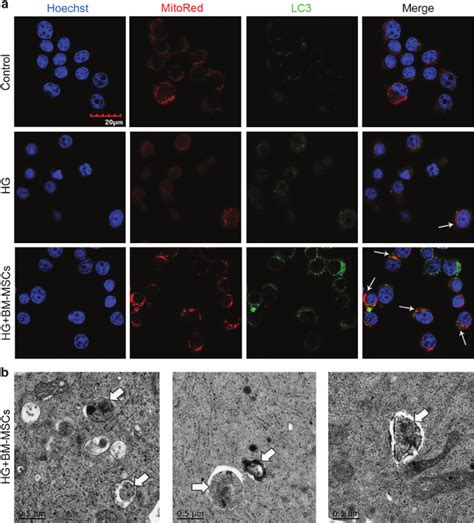 Bm Mscs Promoted Clearance Of Dysfunctional Mitochondria Through Download Scientific Diagram