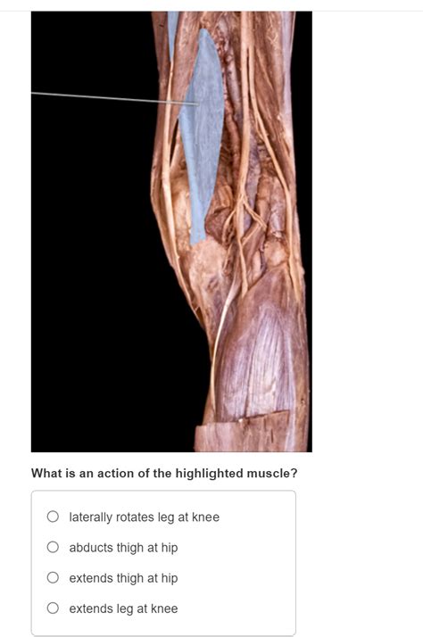 Solved What Is An Action Of The Highlighted Muscle