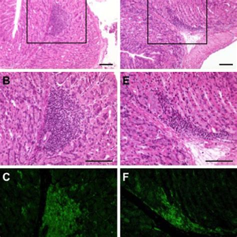 Histology Of The Spleen Of Aig BaLB C Nu Nu Mice Receiving Spleen Cells