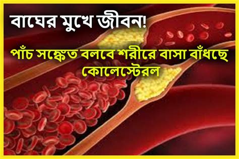 High Cholesterol Control Tips এই পাঁচ ভয়ঙ্কর সঙ্কেতই বলে দেবে শরীরে