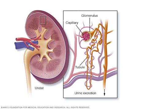 Lupus nephritis - Symptoms and causes - Mayo Clinic