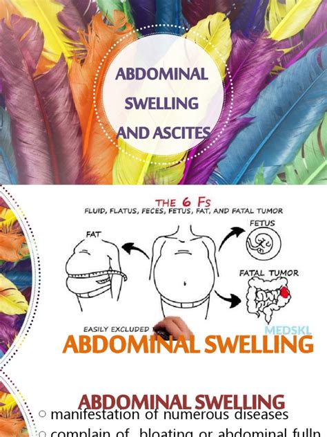 Abdominal Sweliing and Ascites | PDF | Cirrhosis | Bloating