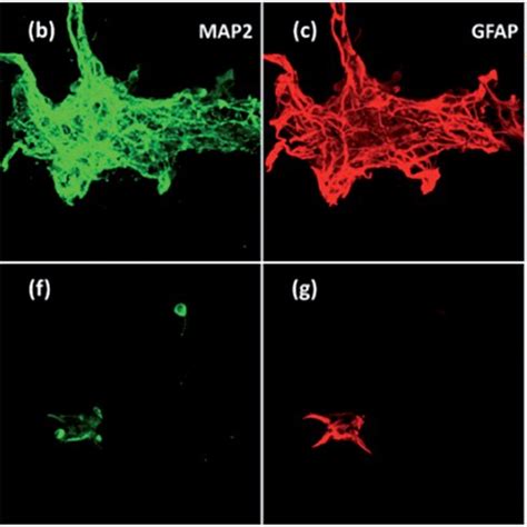 Confocal Fluorescent Images Of Neurons And Glial Cells On Day 7 In The