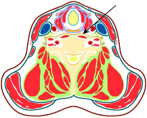 Cross-sectional anatomy of the neck at C6 (cricoid cartilage). Cervical... | Download Scientific ...