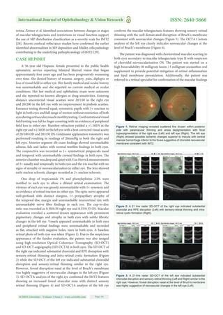 International Journal Of Ophthalmology Vision Research PDF