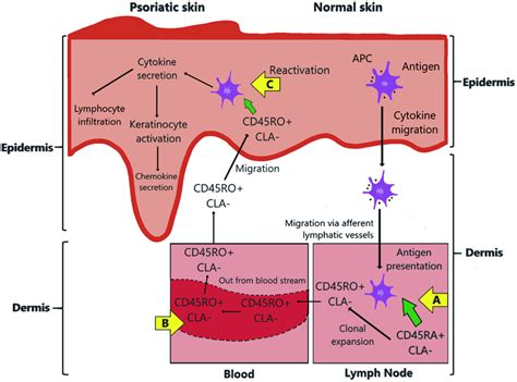 A schematic pathway diagram of psoriasis pathology | Download ...