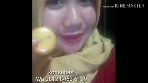 0812 8463 6109 Jual Rinna Diazella SkinCare Di Harapan Mulya Jakarta