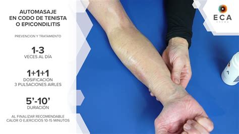 Nos Vemos Microondas A O Nuevo Curar Tendinitis Codo Incentivo Capoc Trono