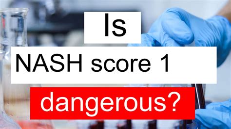 Is NASH score 1 high, normal or dangerous? What does NASH score level 1 ...