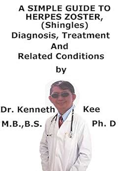 A Simple Guide To Herpes Zoster Shingles Diagnosis Treatment And