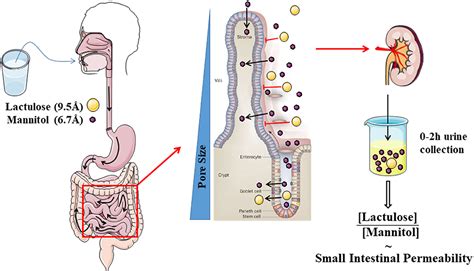 Frontiers The Role Of Intestinal Permeability In Gastrointestinal Disorders And Current