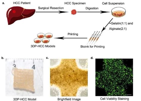 Biomaterials 全球首个3d打印原代肝细胞癌个体化药筛模型 知乎