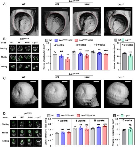 What Causes Increased Lrp1 In Inflammation 2