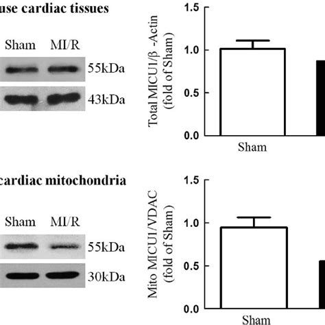 MICU1 Deficiency Aggravated MI R Induced Mitochondrial Injury A