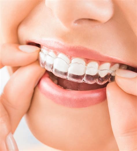 orthodontics harley street dentistinvisalign american dentist