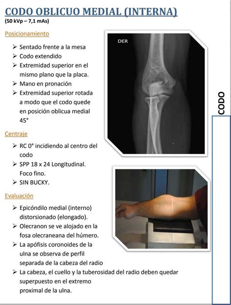 Manual De Proyecciones Radiol Gicas Versi N Compartida Hombro