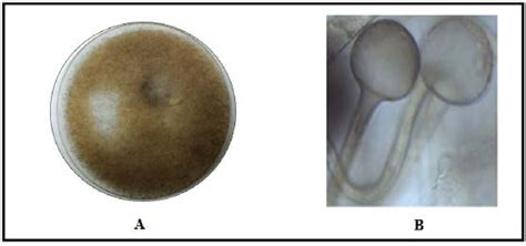 Microscopic Cultural And Morphological Characteristics Of Molds Genus