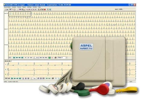 Holter Ekg Aspel Holcard Hlt V Alfa Bytmed