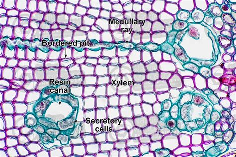 Pinus Sp Pine Stem Transverse Section X Stem Pinus Sp Pine