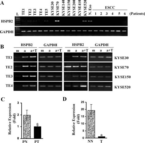 Promoter Hypermethylation Downregulates Expression Of HSPB2 In ESCC