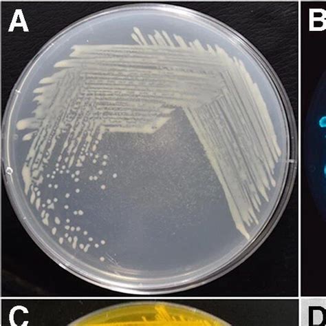 Marine Agar Scheda Del Terreno Di Coltura Per Microbiologia