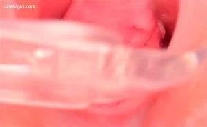 Watch Endoscope Anal Asian Pornhub Porn SpankBang