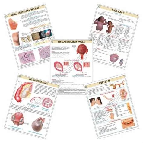 laminated nursing chart  piece  ambala id