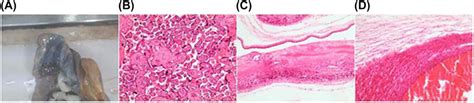 The pathology results of the placenta. (A) The size of the placenta is ...