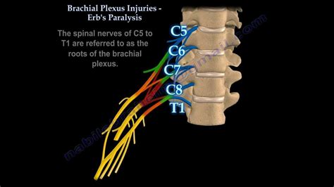 Brachial Plexus Location