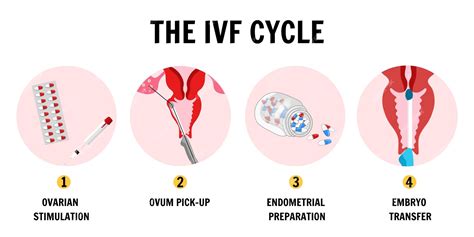 O Conceito De Fertilização In Vitro Do Infográfico Médico Do Ciclo De