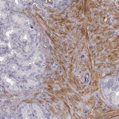 Phosphoglucomutase 5 Antibody (NBP2-62654): Novus Biologicals