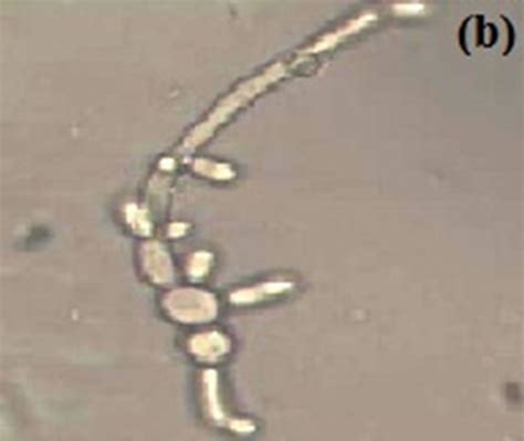 Effect Of Growth Media Ph And Temperature On Yeast To Hyphal Transition In Candida Albicans