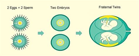 Types Of Twins Parentingnmore