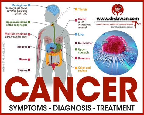 Adenocarcinoma Cancers: Symptoms, Causes, Diagnosis