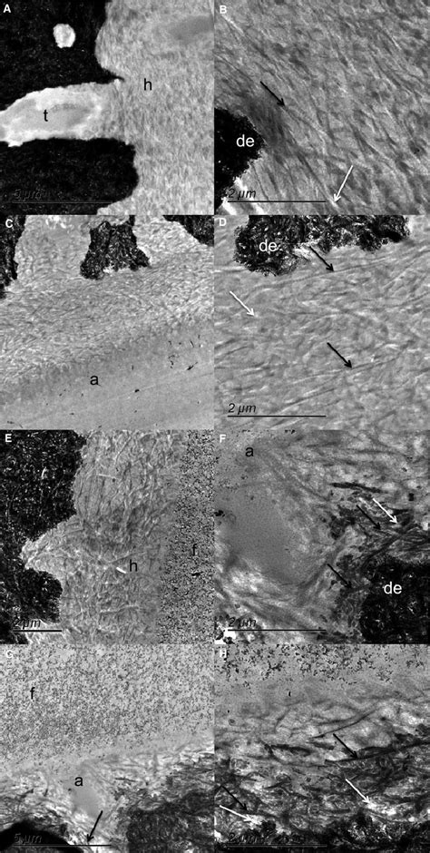 Transmission Electron Microscopy Photomicrograph Illustrating The